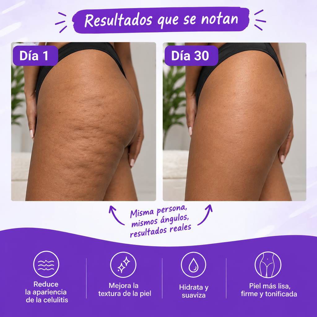 LA SOLUCIÓN A TUS PROBLEMAS! CREMA ANTI-CELULITIS!