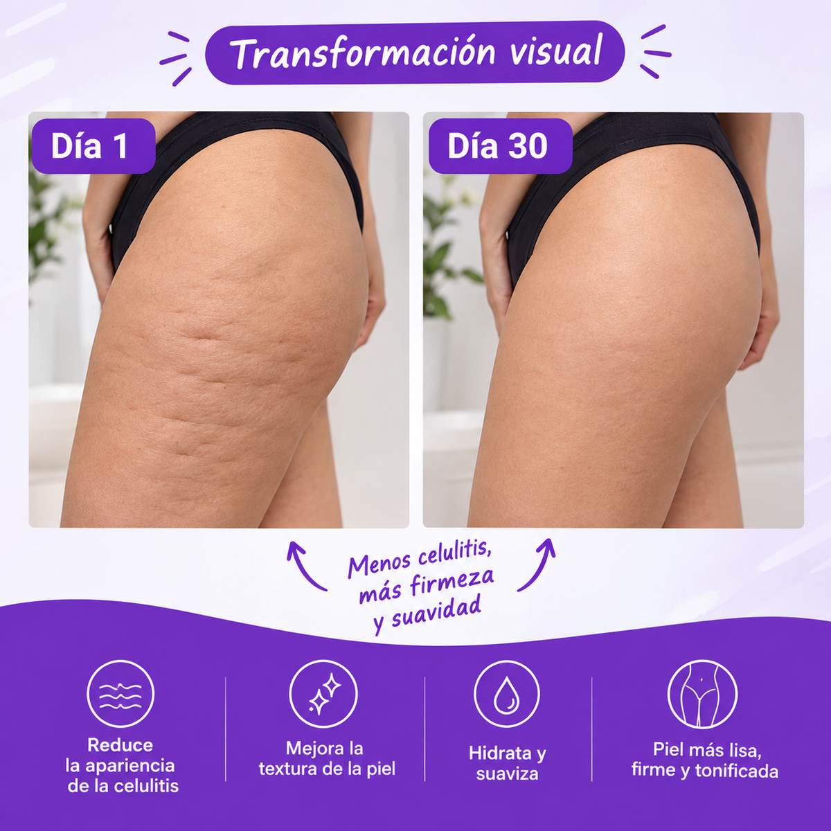 LA SOLUCIÓN A TUS PROBLEMAS! CREMA ANTI-CELULITIS!